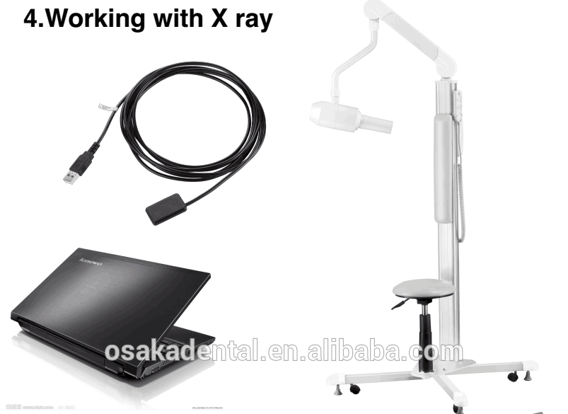 dental italy trident DS730 digital / Excelente imagen sensor de rayos x
