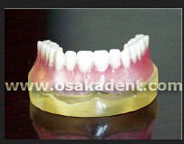 Forma dental del modelo de enseñanza de dientes de implante