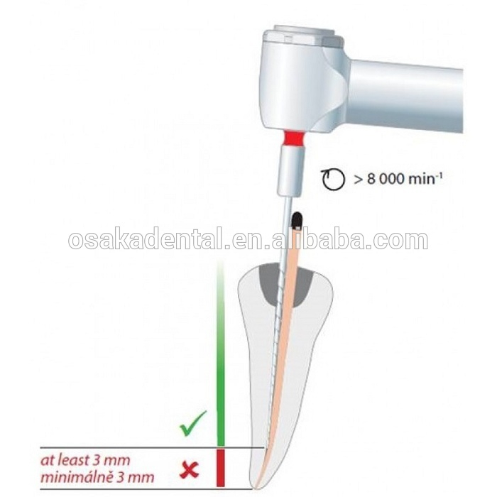 Dental Endo files Gutta condensor files