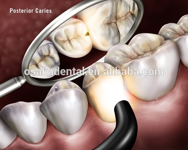 suministro dental dental led curado bombilla en tipo led luz de curado