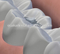 El amalgamador dental digital con aprobación CE puede imprimir su propio logotipo