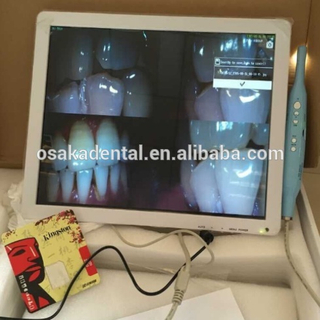 Monitor blanco de 17 pulgadas + cámara intraoral dental con soporte para monitor VGA + VIDEO + US B +