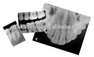 Venta caliente CE aprobó el procesador de película dental de rayos X