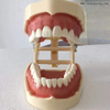 Modelo de enseñanza de ortodoncia dental que puede probar con microtornillos