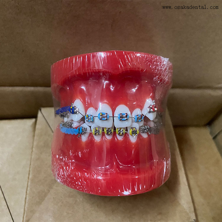 Modelo de ortodoncia de dientes dentales para la enseñanza del dentista
