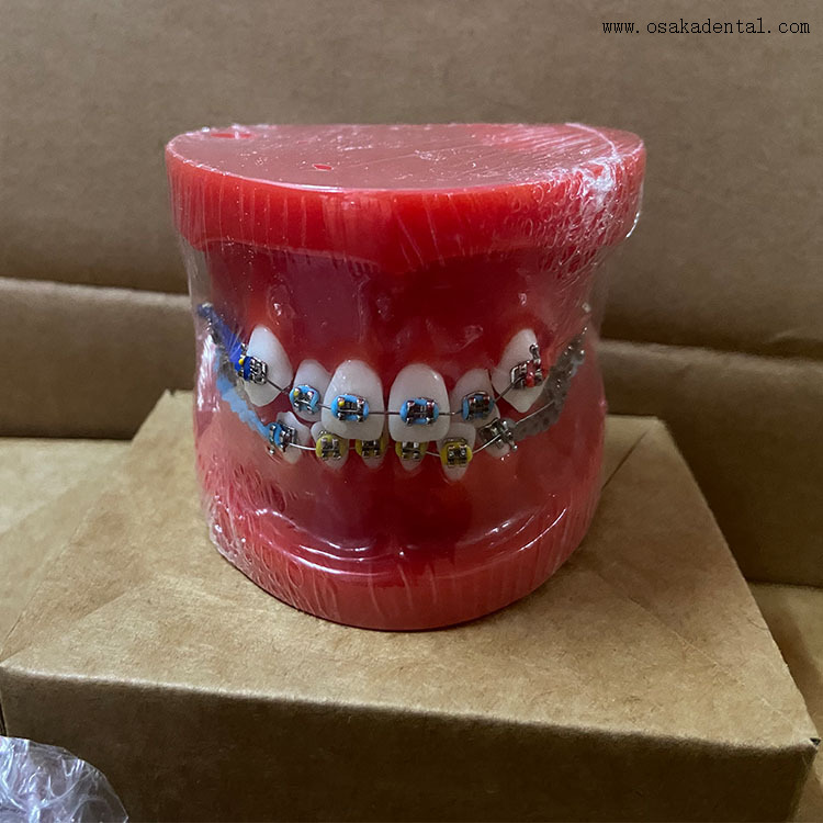 Modelo de ortodoncia de dientes dentales para la enseñanza del dentista