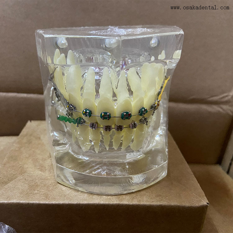 Modelo de ortodoncia de dientes dentales para la enseñanza del dentista