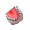 Accesorios de ortodoncia dental Mini educador de espolón lingual