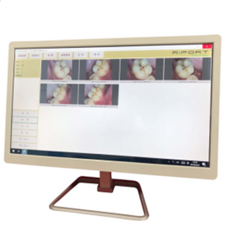 Sistema de computadora con la cámara táctil y el monitor intraoral dental para la silla dental