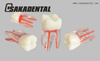 Molde de estudio de dientes de conducto radicular dental