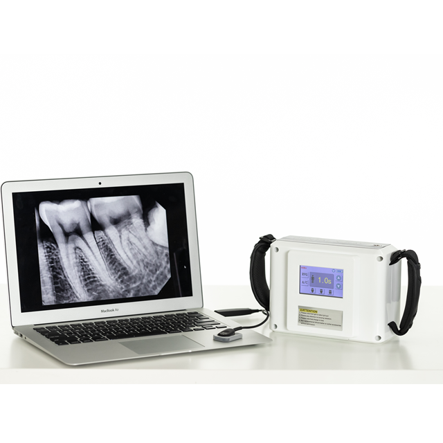 Unidad de rayos X digital inalámbrico dental estable