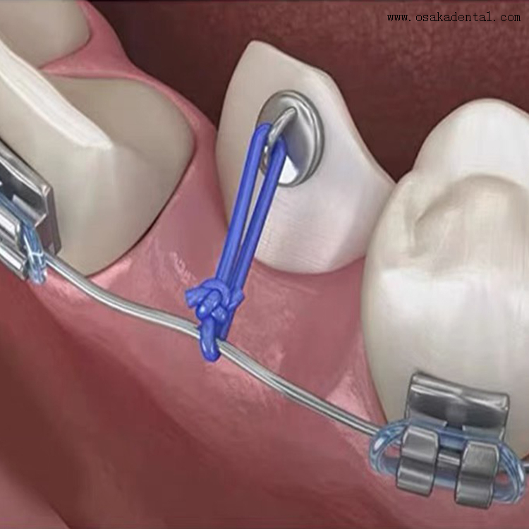 Hilo de ortodoncia dental del poder de los 25ft de los accesorios de ortodoncia dental 