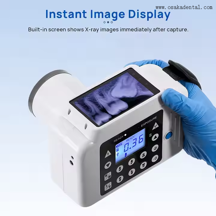 Máquina de unidad de rayos X Dental portátil con pantalla de imagen LCD instantánea y máquina de rayos X Dental con Sensor incorporado