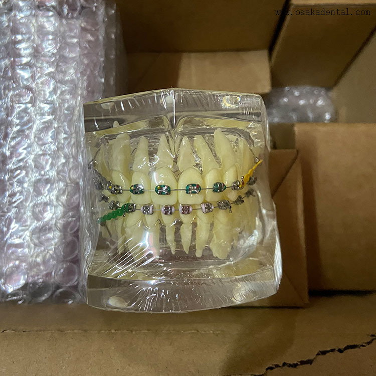Modelo de ortodoncia de dientes dentales para la enseñanza del dentista