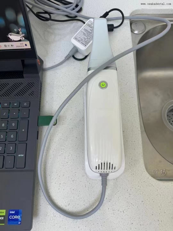 Escáner bucal 3D de alta tecnología para análisis dentales precisos