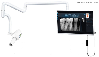 Sensor digital dental con máquina de rayos X dental para uso clínico dental