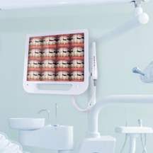 Cámara intraoral dental y monitor con WiFi para silla dental.