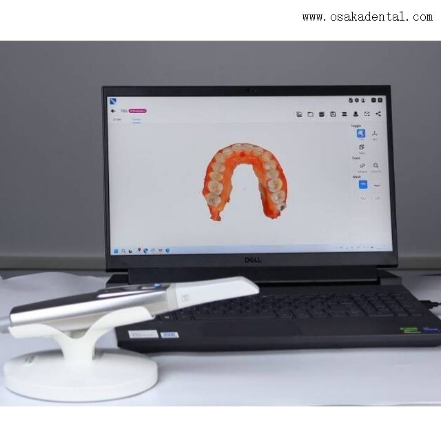 Escáner intraoral dental 3D