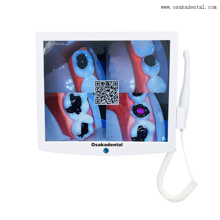 Monitor de sillón dental con cámara bucal