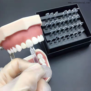 La herramienta para carillas dentales Ueneer simplifica el arte dental