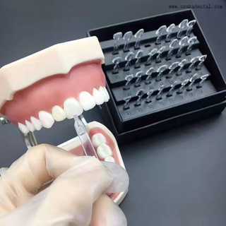 La herramienta para carillas dentales Ueneer simplifica el arte dental