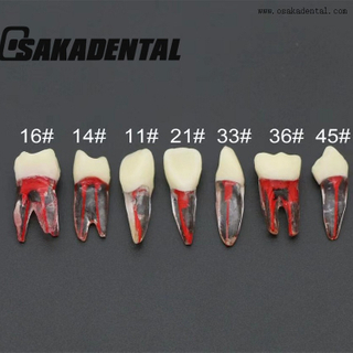 Molde de estudio de dientes de conducto radicular dental