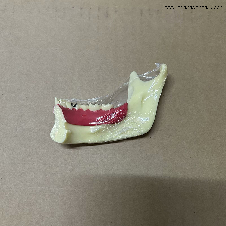Modelo de dientes de descomposición mandibular dental 