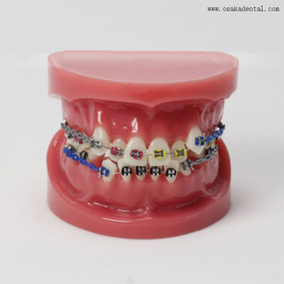 Modelo de ortodoncia de dientes dentales para la enseñanza del dentista