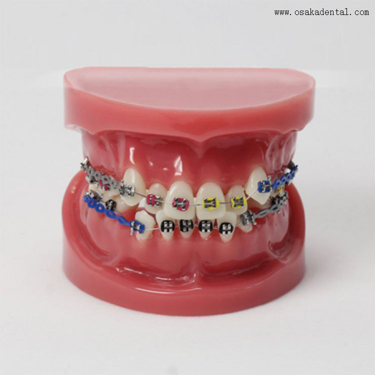 Modelo de ortodoncia de dientes dentales para la enseñanza del dentista