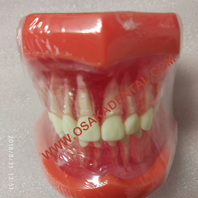 Modelo de enseñanza de forma dental Modelo de tamaño natural (extraíble) / Modelo de enseñanza de prótesis