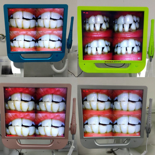 Colorido monitor de 17 pulgadas + Cámara intraoral dental Wifi con soporte para monitor VGA + VIDEO + US B +
