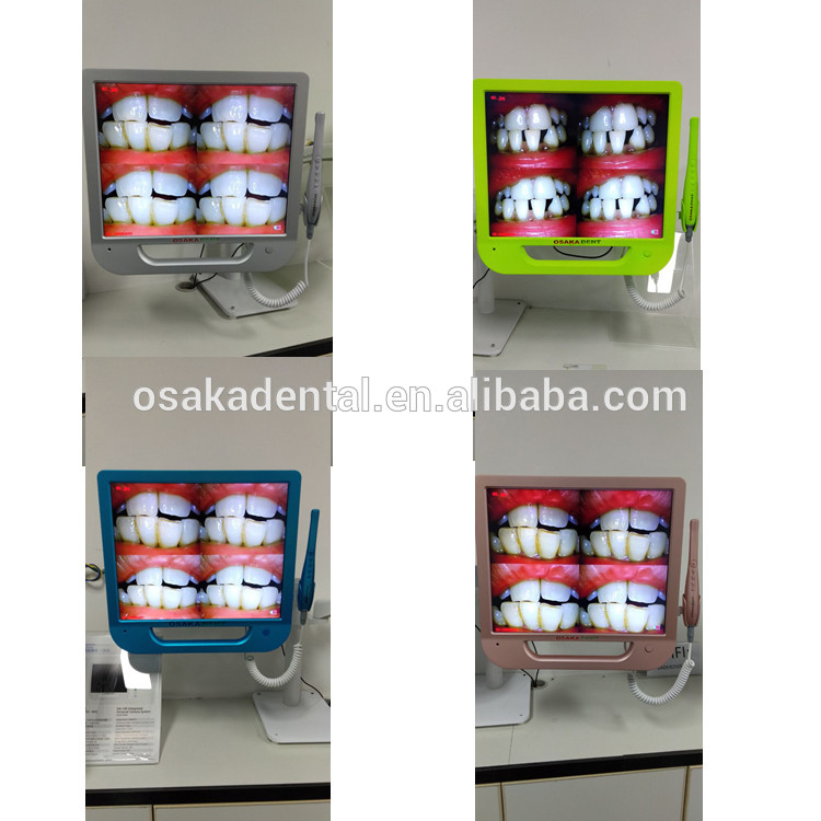 Una cámara intraoral dental de monitor colorido de 17 pulgadas con VGA y VIDEO y USB y WIFI que incluye soporte para monitor